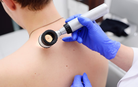 Clínica Uroderm, Mapeamento Corporal e Dermatoscopia Digital em Montes Claros, MG